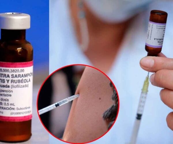 Sarampion_Barrio-600x500 Inicio